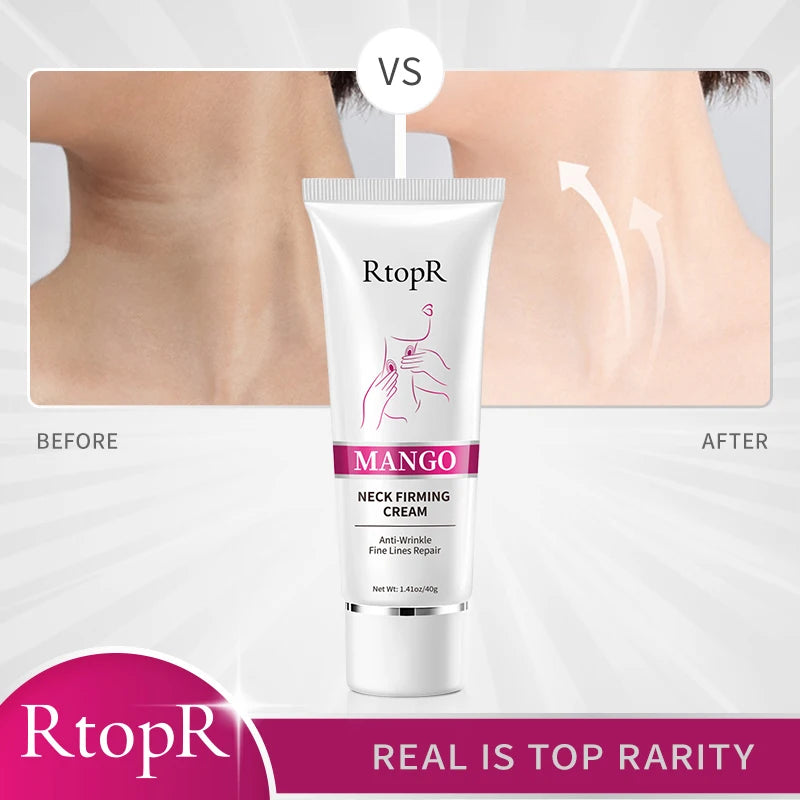 Mango Neck Firming Cream Anti-Wrinkle Fine Line Repair Neck Cream Mild Whitening Moisturizing Hydrating Neck Treatment 40G