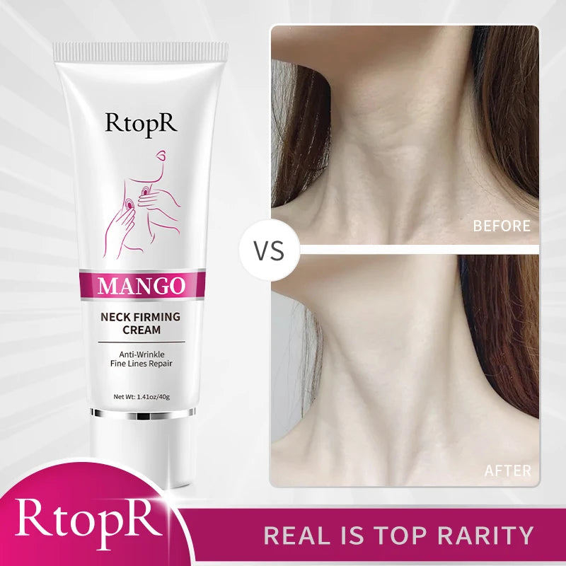 Mango Neck Firming Cream Anti-Wrinkle Fine Line Repair Neck Cream Mild Whitening Moisturizing Hydrating Neck Treatment 40G