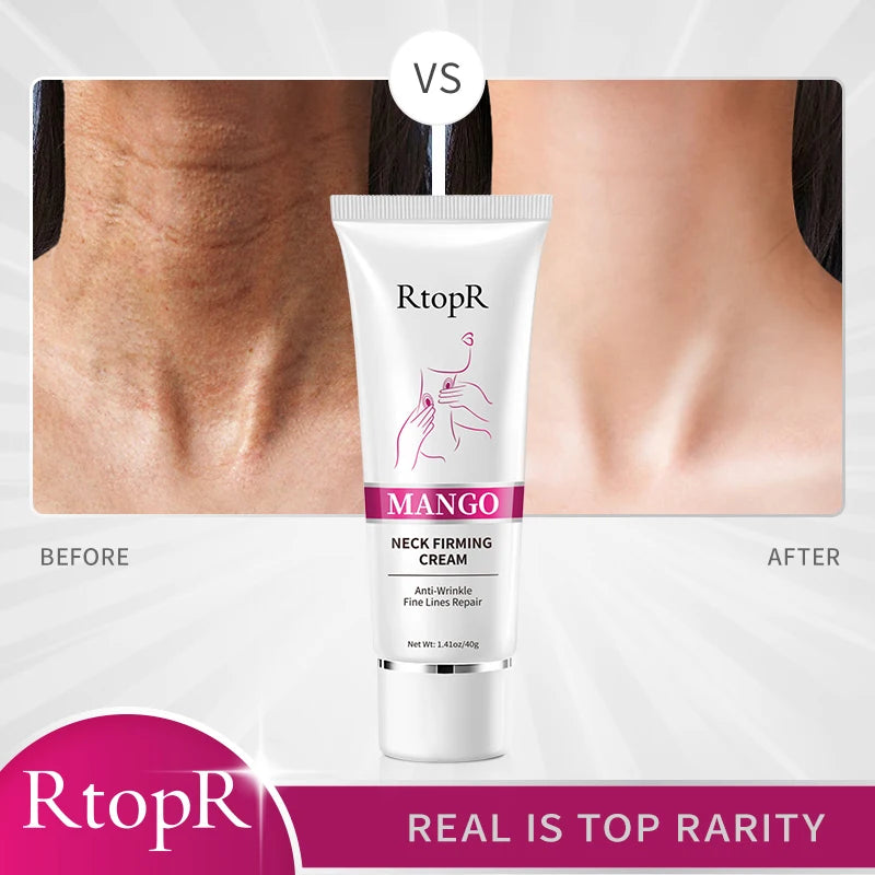 Mango Neck Firming Cream Anti-Wrinkle Fine Line Repair Neck Cream Mild Whitening Moisturizing Hydrating Neck Treatment 40G